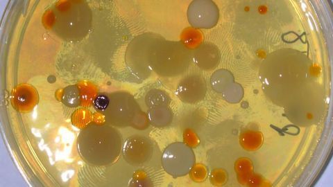 Revealing How Starvation Can Increase Lifespan for Bacteria