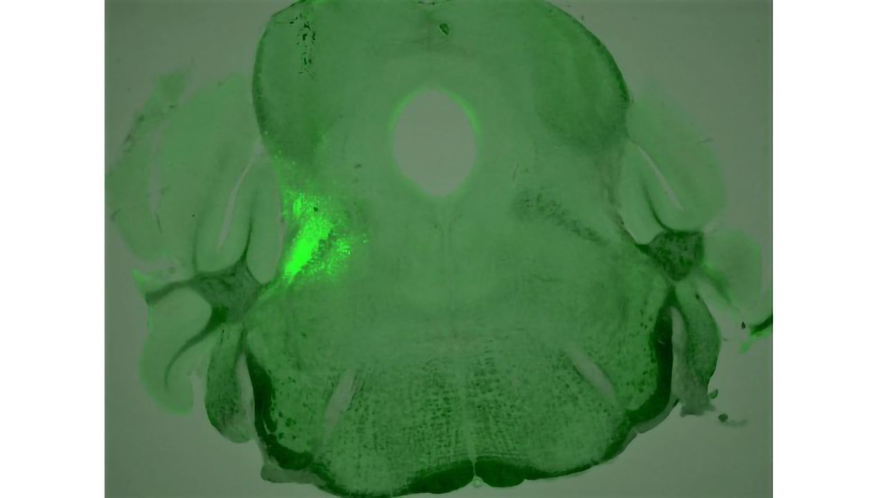 Neurons Involved in Opioid Overdose Identified