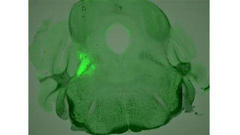 Neurons Involved in Opioid Overdose Identified