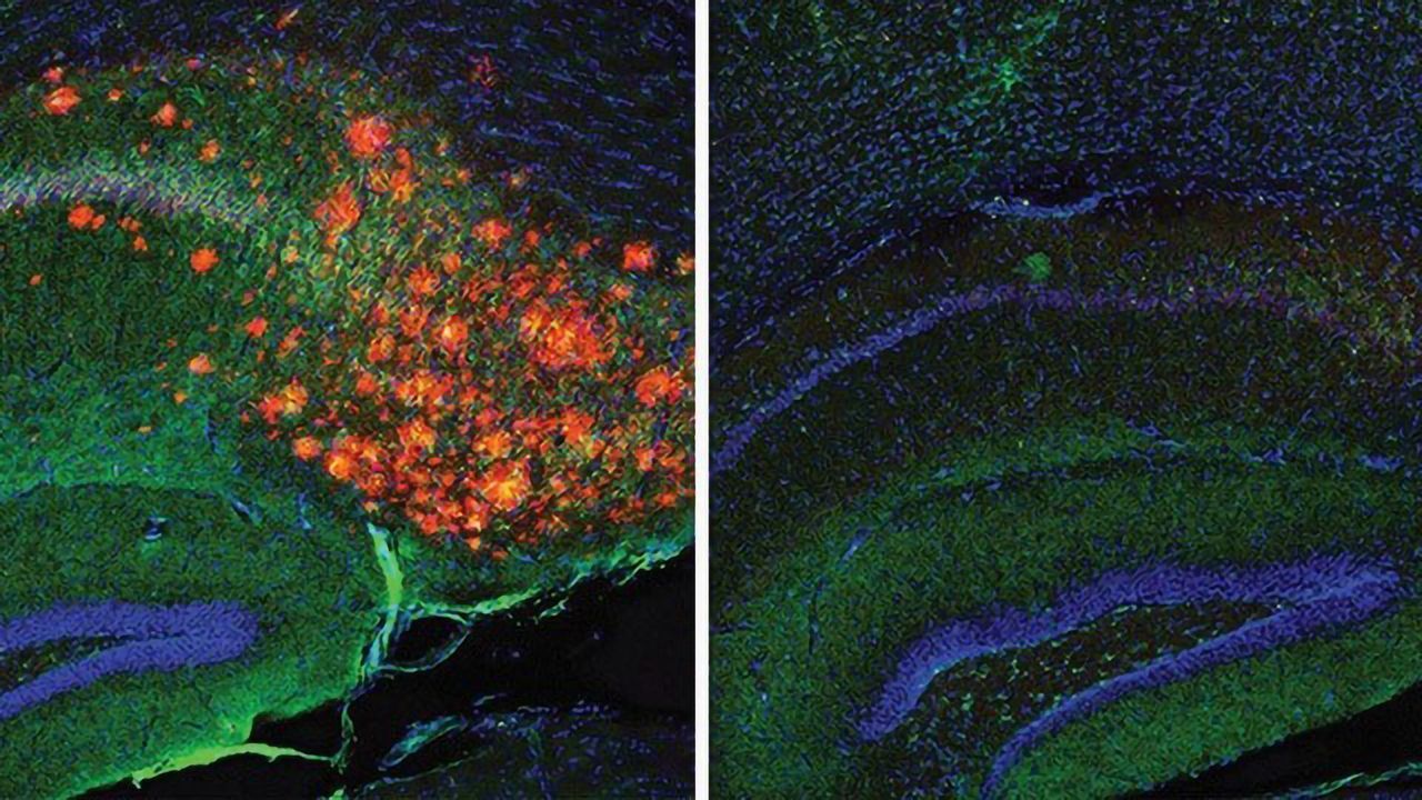 Brain Cholesterol Tightly Regulates Amyloid Plaques