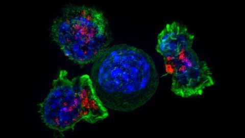 Investigational Inhibitor Improves Responses to Cellular Therapies in Advanced Leukemias