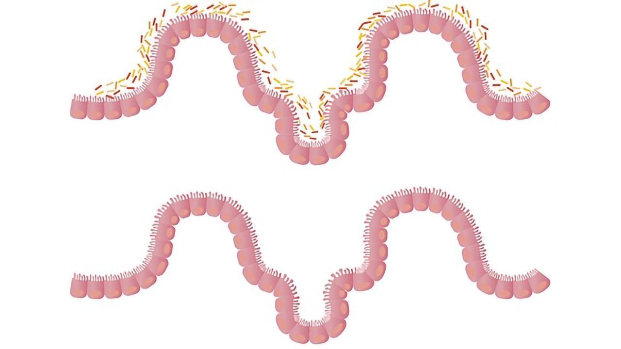 Gut Microbes Can Accelerate Cognitive Decline, Finds Mouse Study