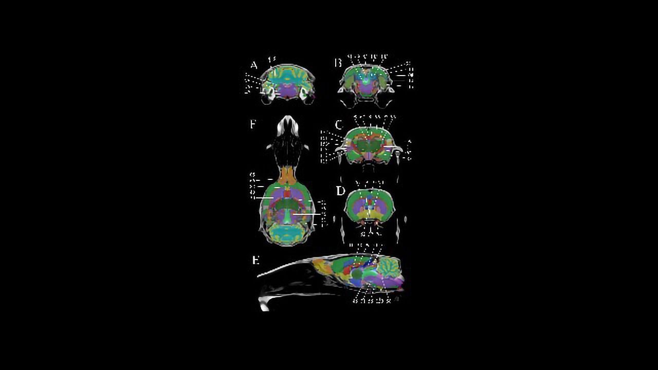 Ratlas: A New Rodent Brain Atlas Set To Revolutionize Neuroscience