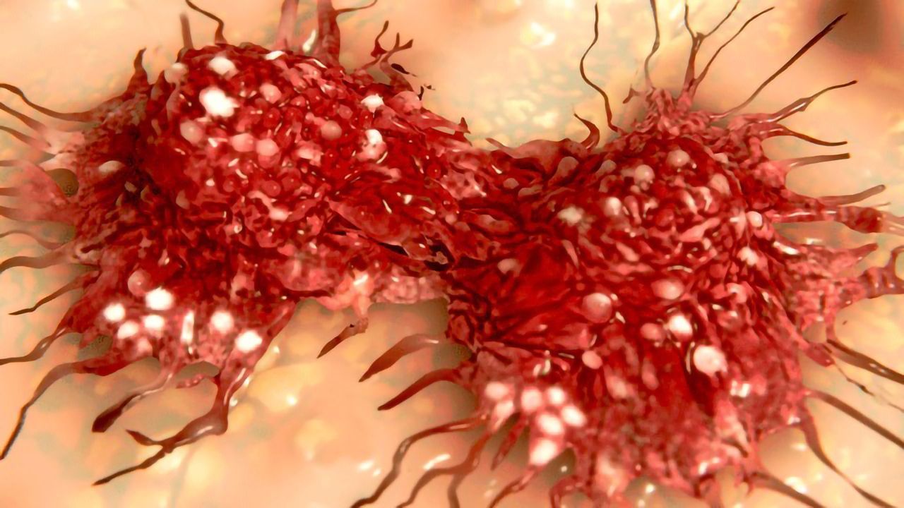 Circular RNA Shown To Inhibit Metastasis of Gastric Cancer