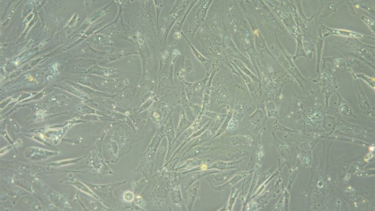 Set of Biomarkers Helps To Predict Best Treatment for Brain Cancer Patients