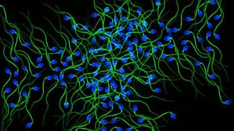 Key Protein Helps Sperm Do Their Job in a Timely Fashion