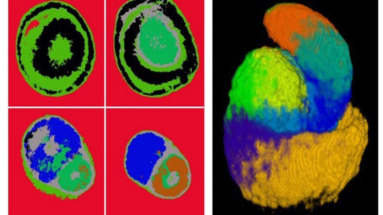 How Human Kidneys Form Their Filtering Units