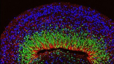 Brain Organoids With Complex Neural Activity Developed