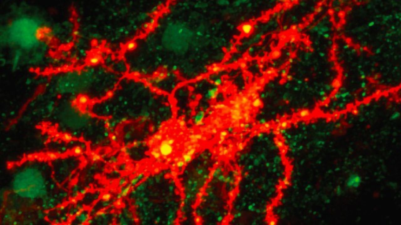 How Old Habits Are Shaken Off in the Brain
