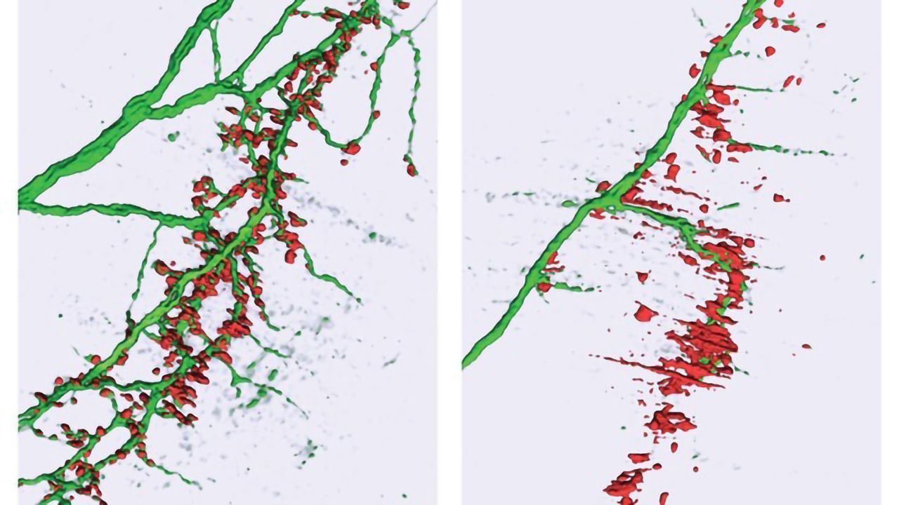 Subtle MicroRNA Changes May Lead to ALS