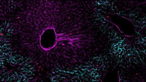Hobit Drives Immune Cells To Be Killers