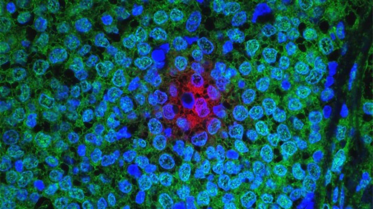 Dual-Action Compounds Target Estrogen-Sensitive Breast Cancer Cells