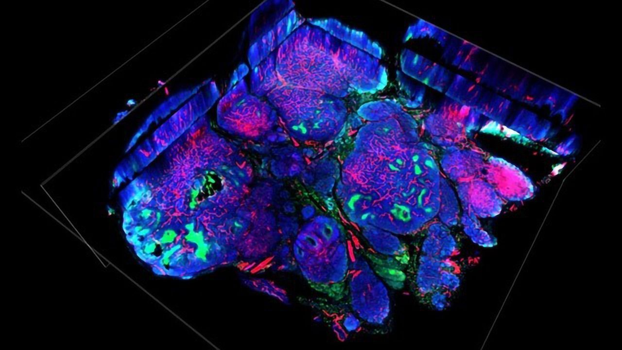 Exploiting Weaknesses in Enzyme Used by Cancer Cells To Adapt