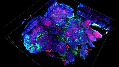 Exploiting Weaknesses in Enzyme Used by Cancer Cells To Adapt