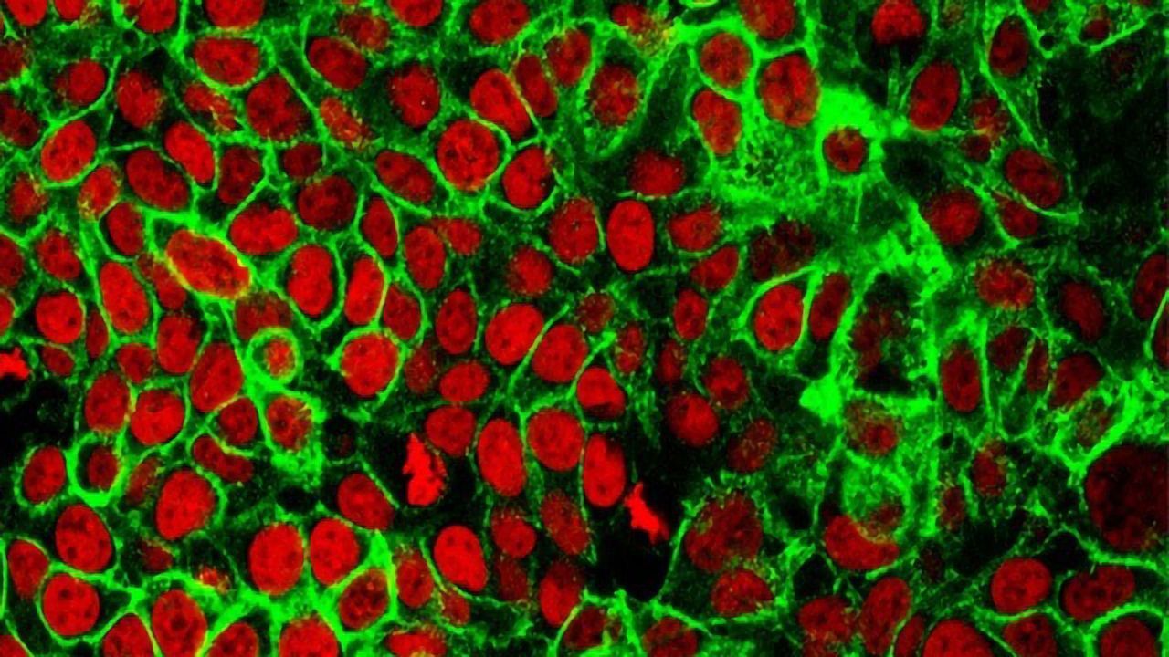 Tracing the Developmental Trajectories of Colorectal Cancer Cells