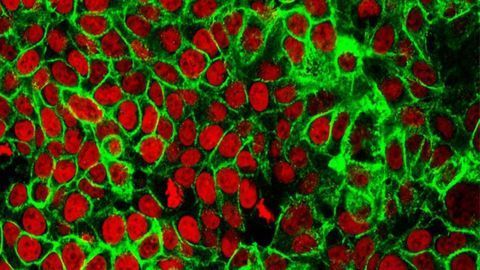 Tracing the Developmental Trajectories of Colorectal Cancer Cells