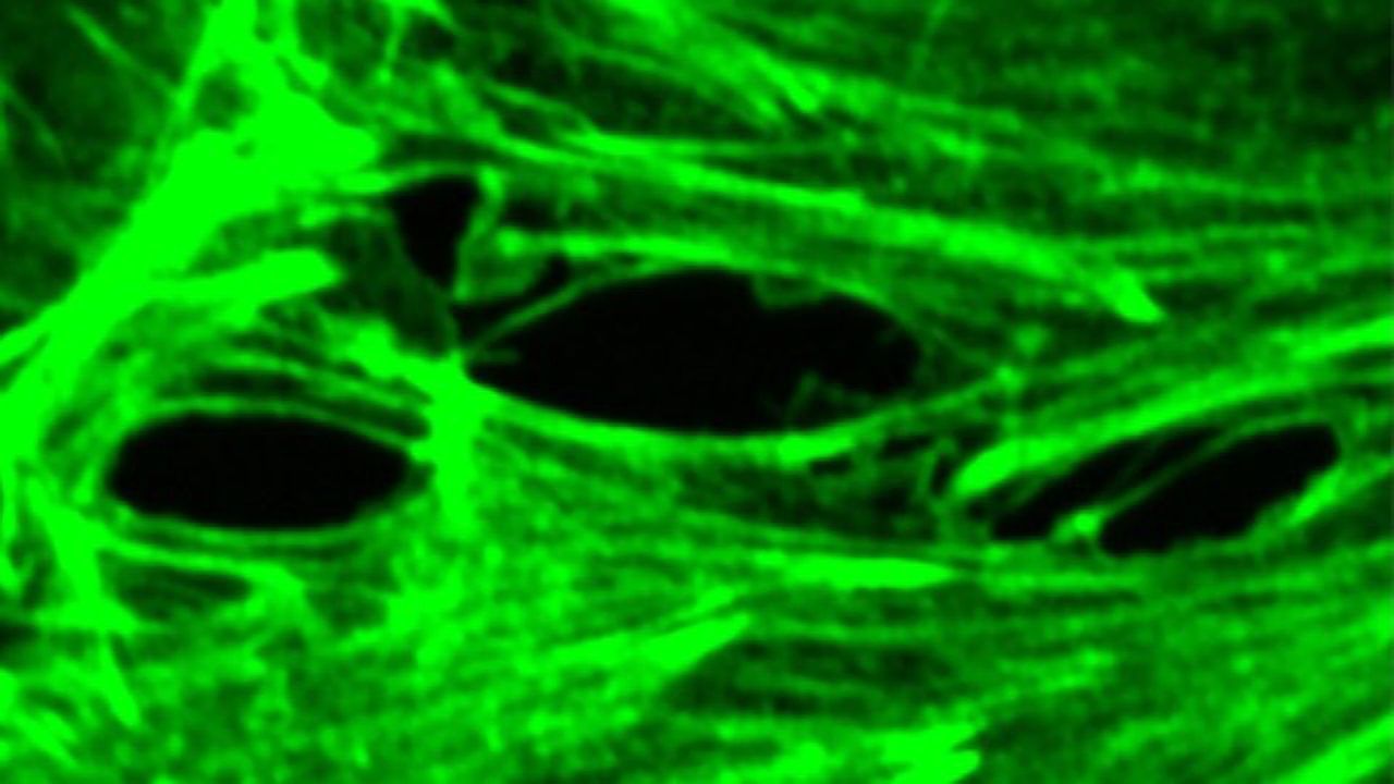 Stabilizing Patients With Sepsis by Regulating Blood Vessel Leakage