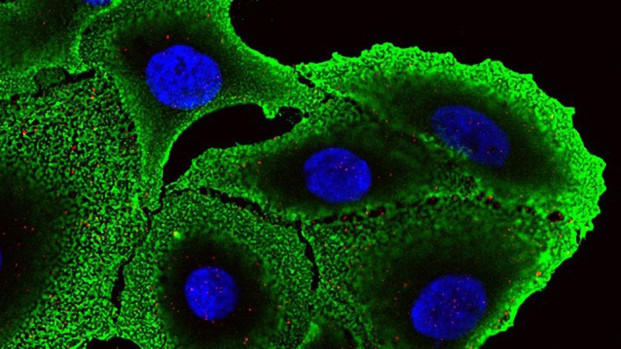 Chemoresistant Colon Cancer Cells