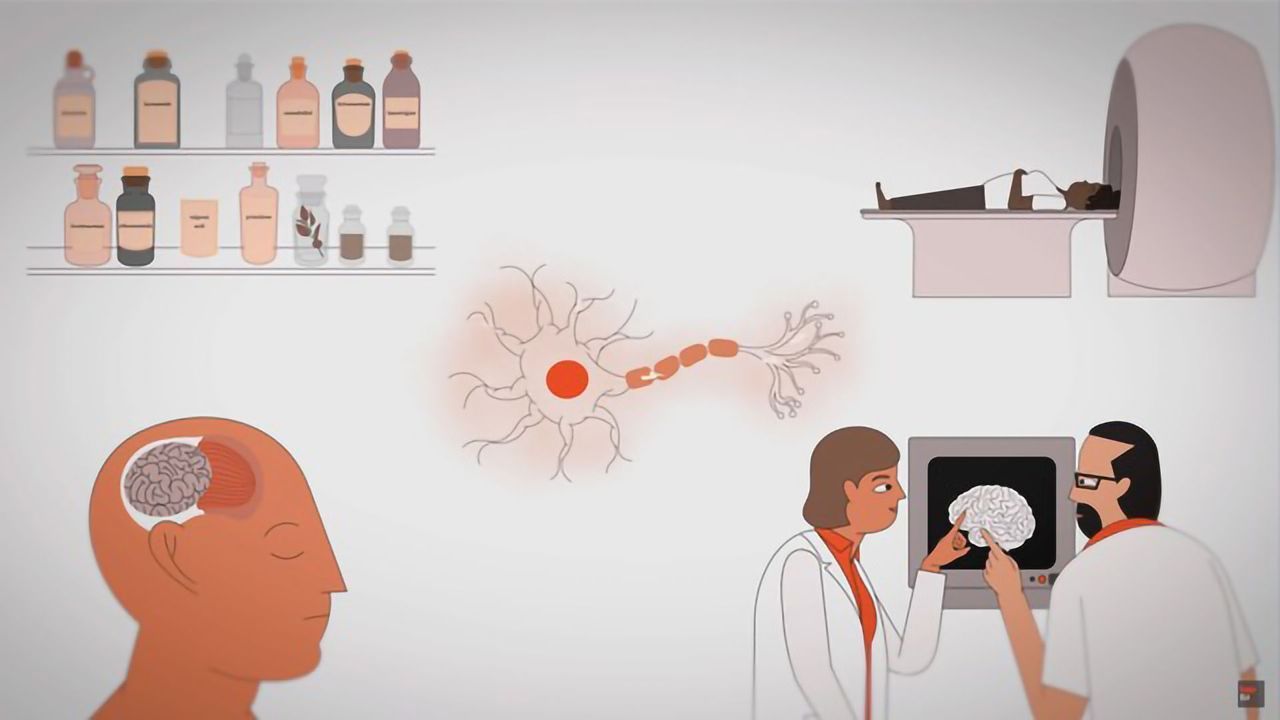 What Causes Seizures and How Can We Treat Them?