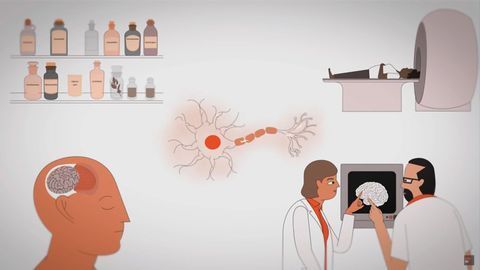 What Causes Seizures and How Can We Treat Them?