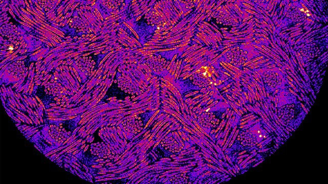 Cells Rewired To Release Drug in Response to Inflammation