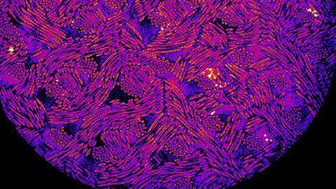 Cells Rewired To Release Drug in Response to Inflammation