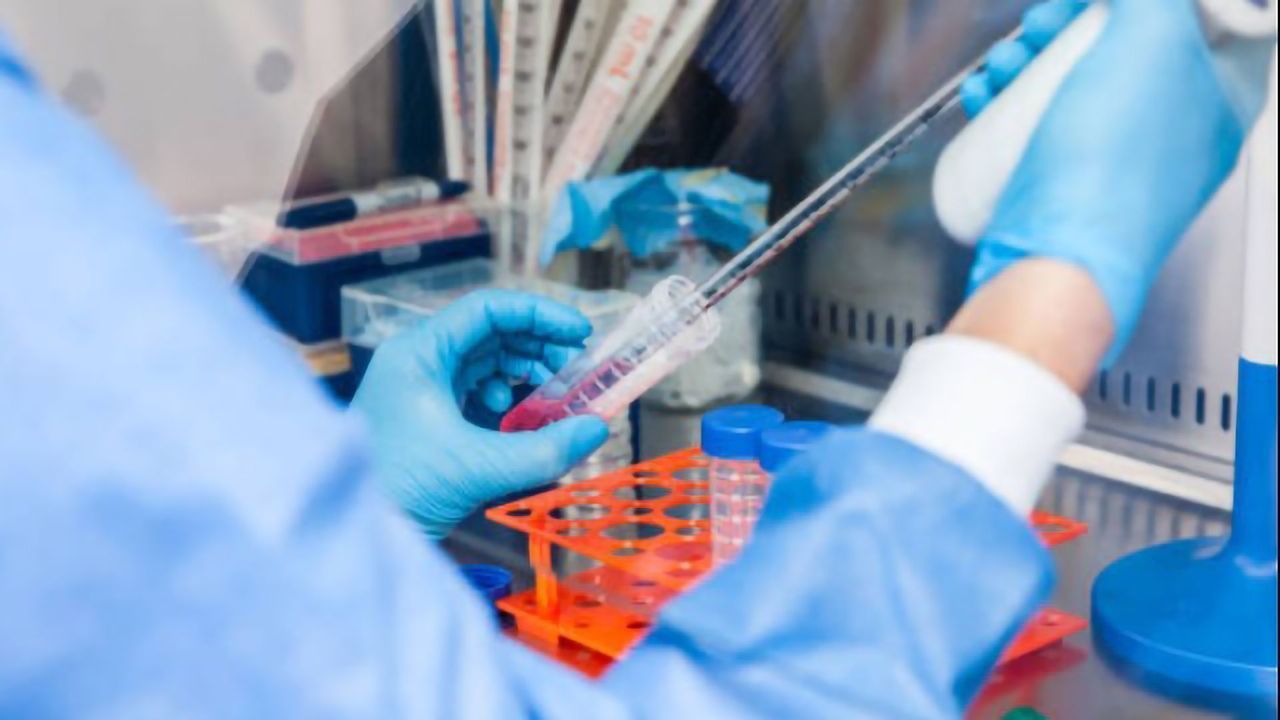 Benefits of an Ergonomic and Electronic Pipette for RT-PCR