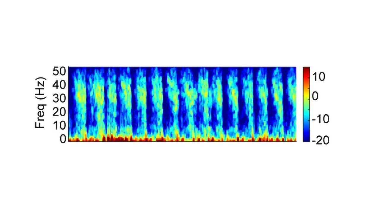 Ketamine Findings Reveal Anesthesia Mechanism