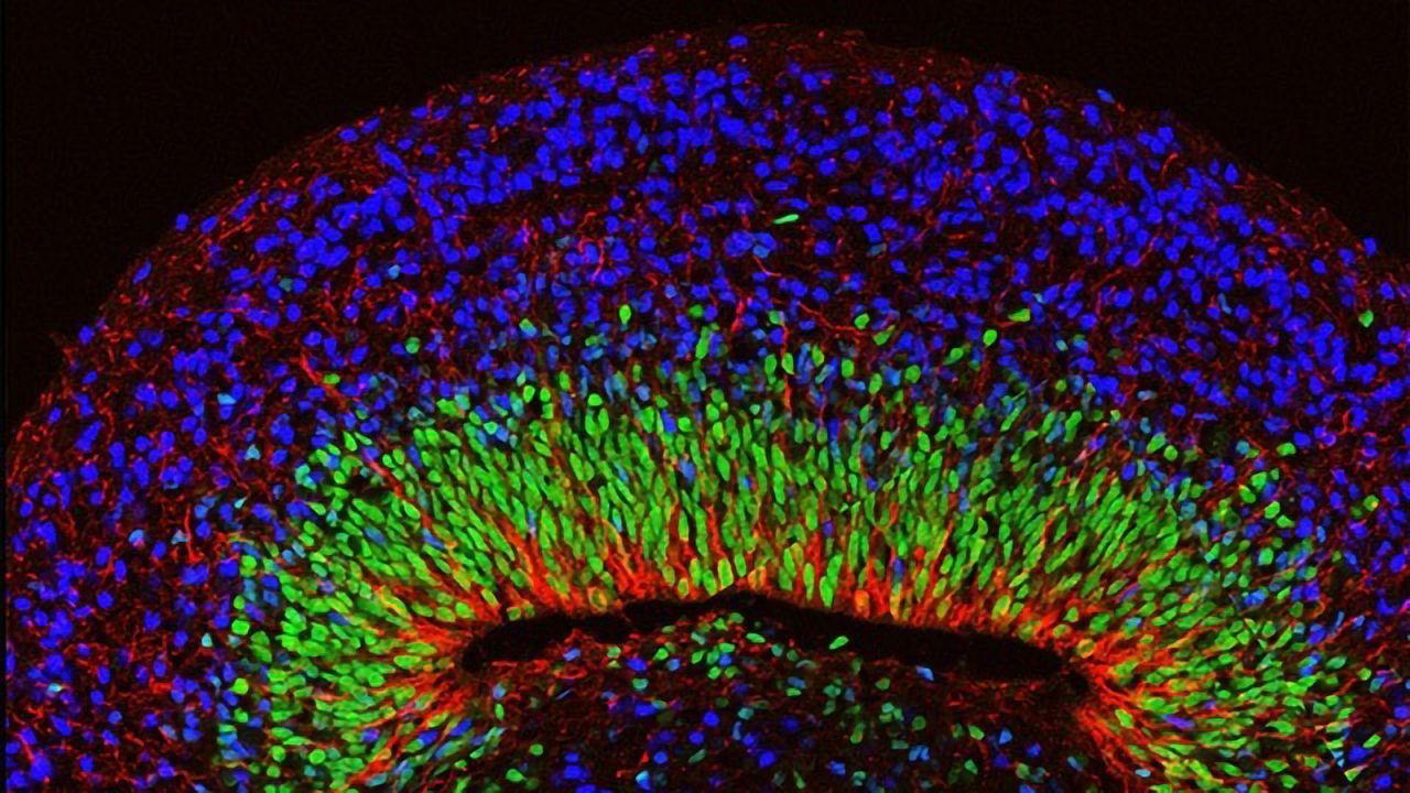 Mini Brain Organoid