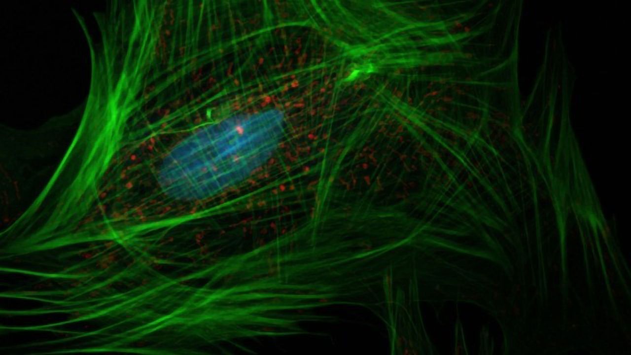 Factors That Turn Normal Cells Into Liver Cancer Cells Identified