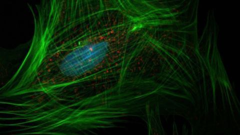 Factors That Turn Normal Cells Into Liver Cancer Cells Identified