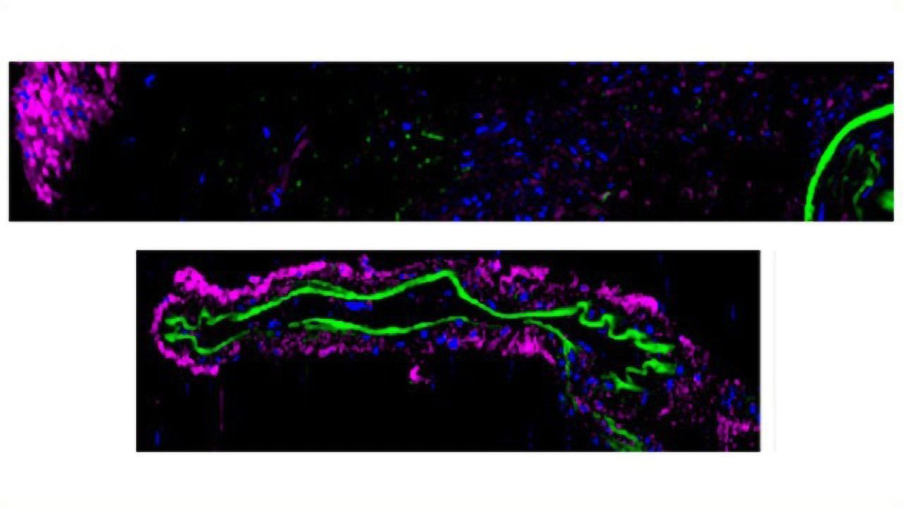 Therapeutically Modulating Cerebral Blood Flow