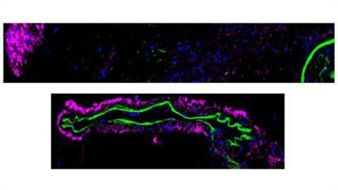 Therapeutically Modulating Cerebral Blood Flow