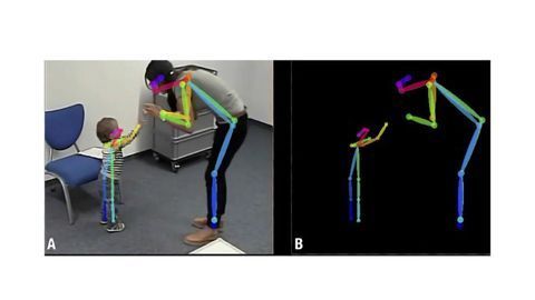 Video Analysis Tool Allows for Early Autism Diagnosis