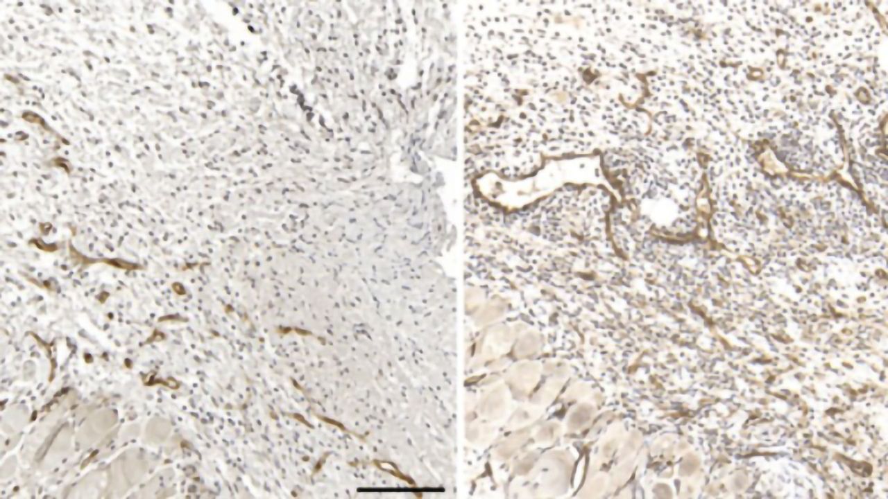 Natural Killer Cells Balance Wound Healing Trade-Off