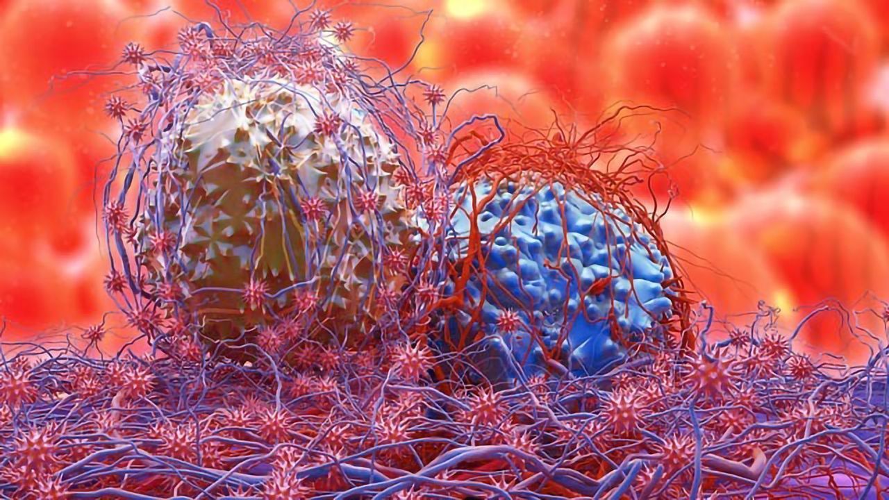 Population of Treatment-Resistant Cells Identified in Prostate Cancer Samples