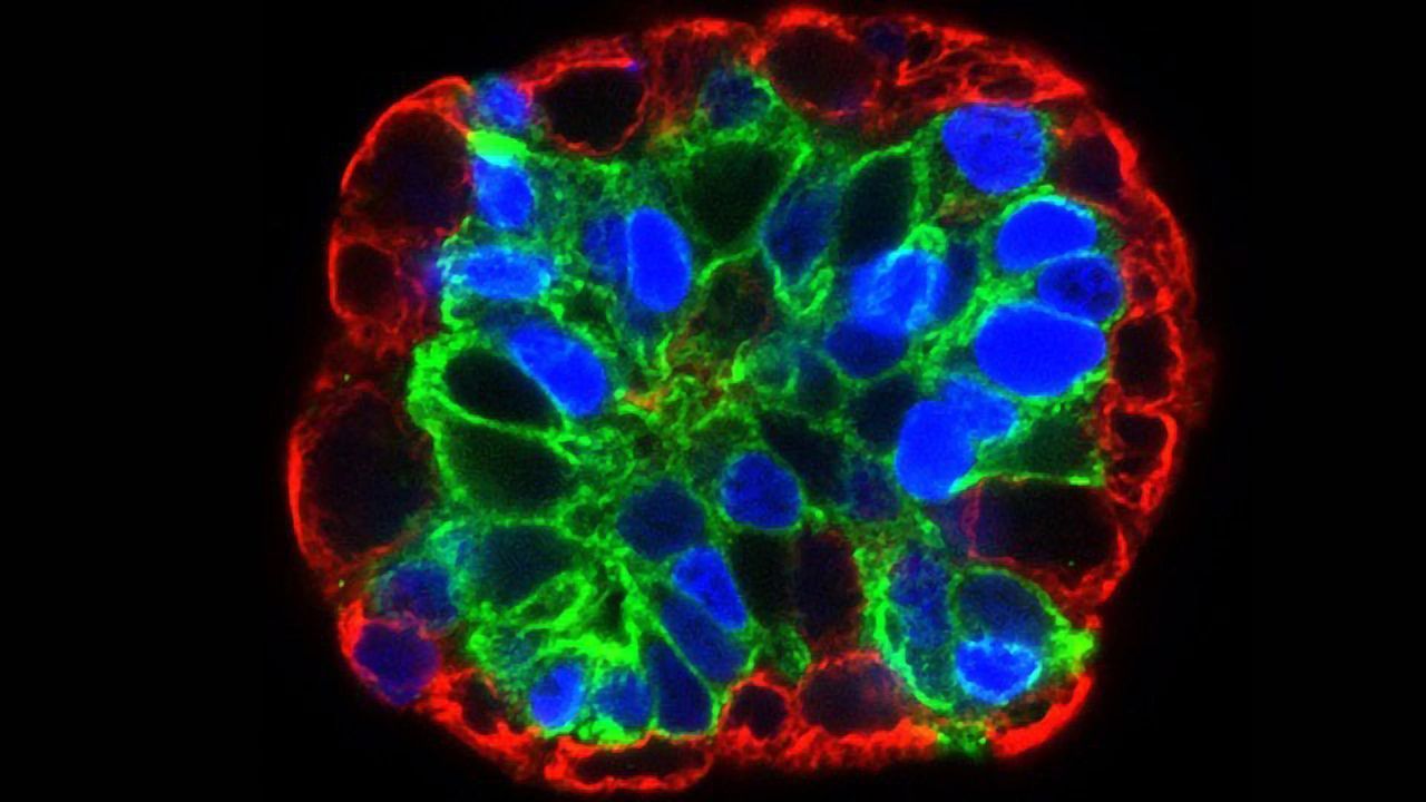 How Organoids Are Fueling Infectious Disease Research and Personalized Medicine