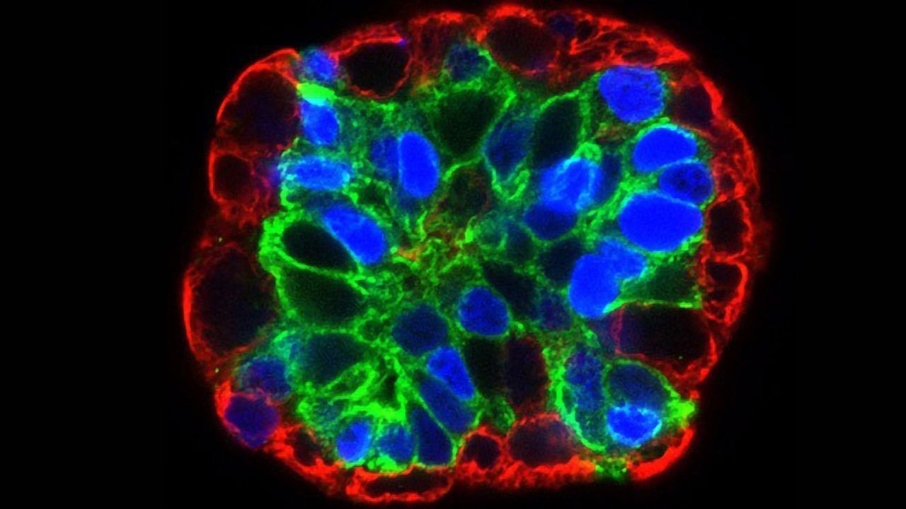 How Organoids Are Fueling Infectious Disease Research and Personalized ...