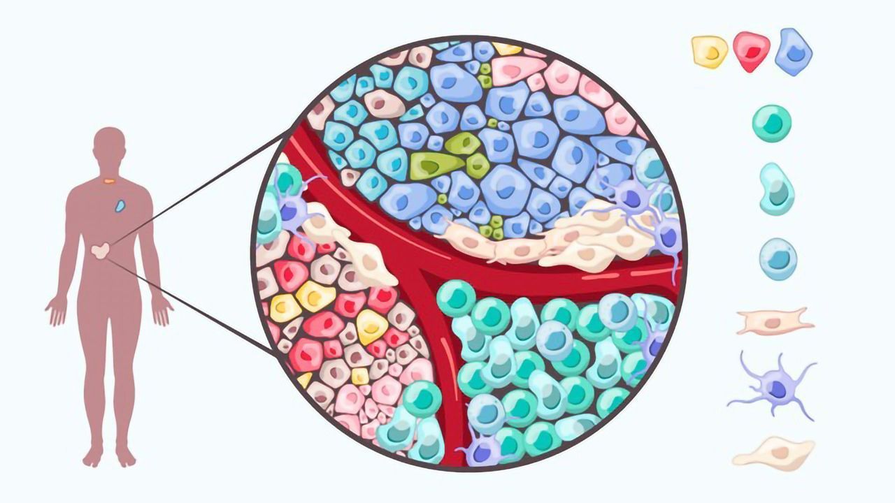 Tumor Heterogeneity