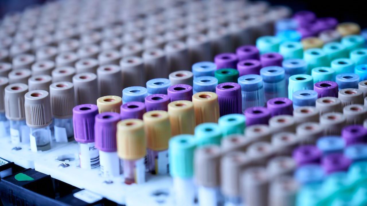 33 Blood Metabolites Differ in Dementia