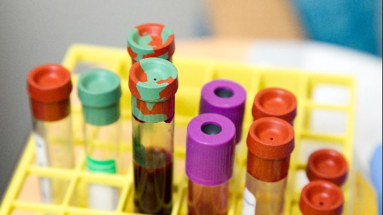First Trial of Blood Test That Detects Over 50 Types of Cancer
