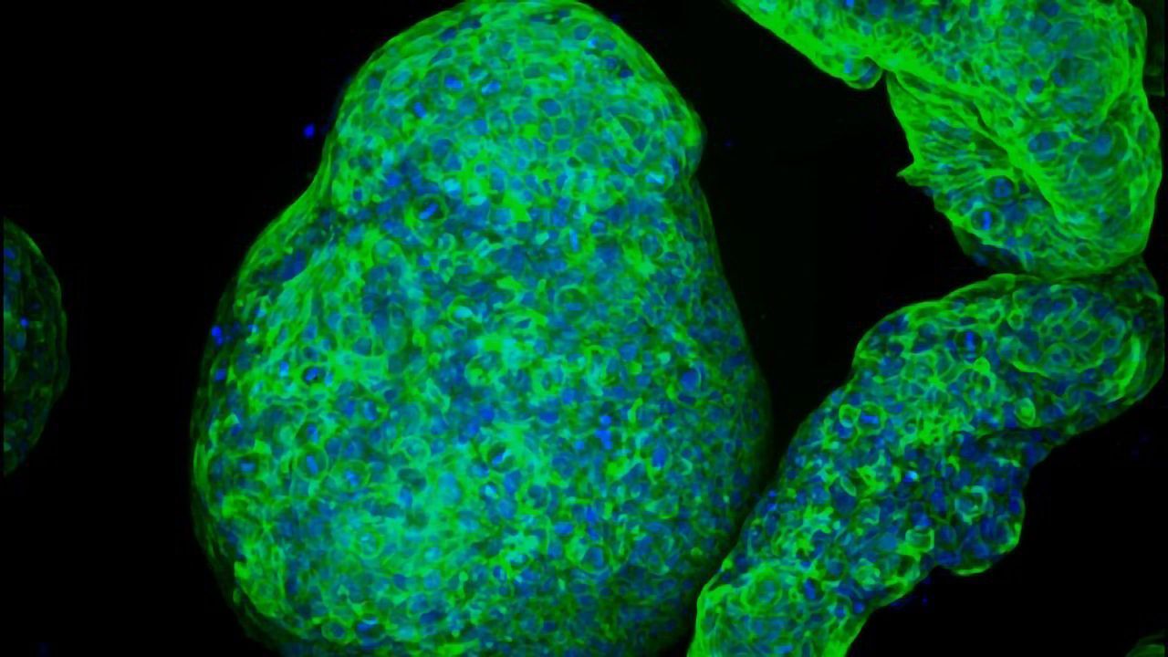 A New Way To Grow Pancreatic Organoids Developed