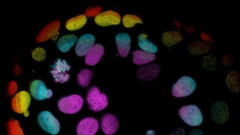 How Organoids Help Us Understand Ourselves and Treat Diseases
