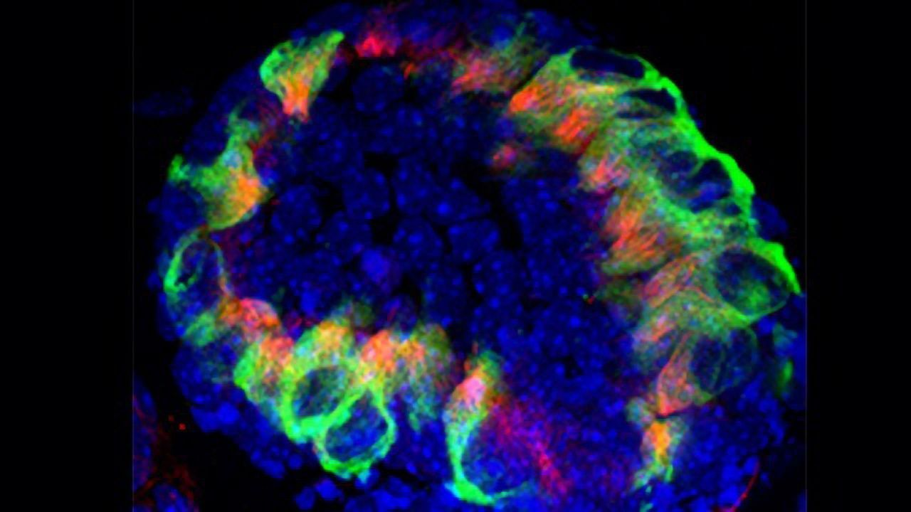 Treating Hearing Loss: The Hunt for Drugs That Promote Hair Cell Regeneration