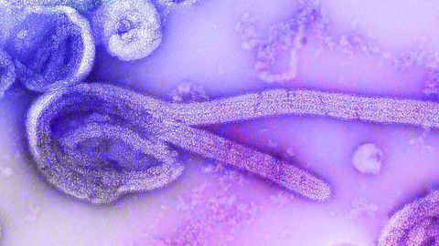 Proteins Enhance Immune Response to HIV, Ebola and Zika