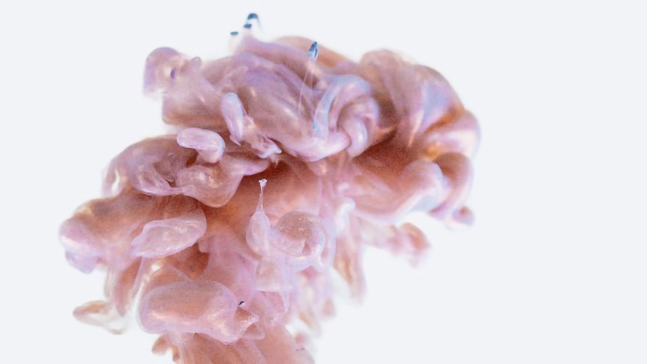 Antioxidant Fails To Slow Parkinson’s Disease Progression in Clinical Trial