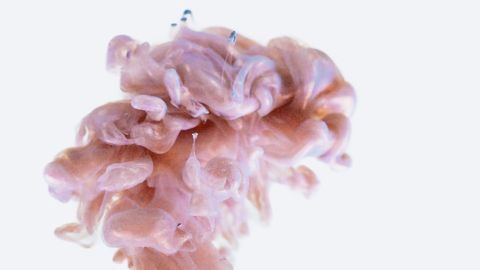 Antioxidant Fails To Slow Parkinson’s Disease Progression in Clinical Trial