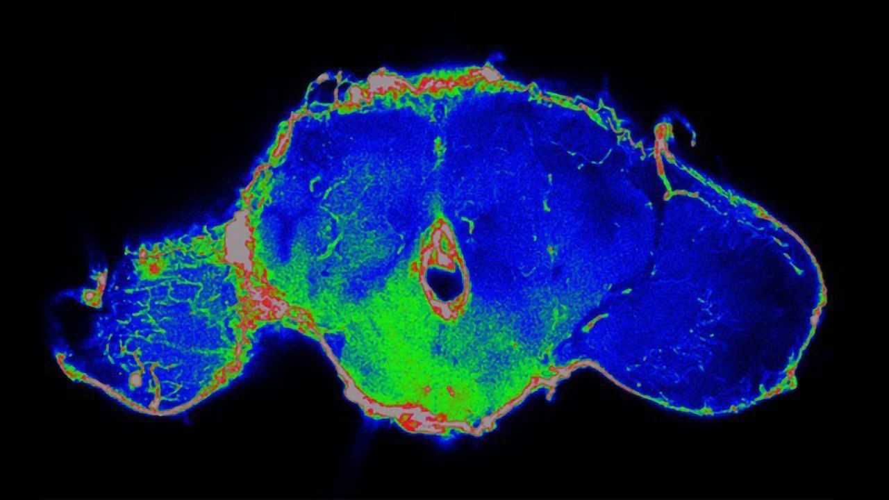 Fruit Fly Research Is Helping To Discover New Anticancer Strategies