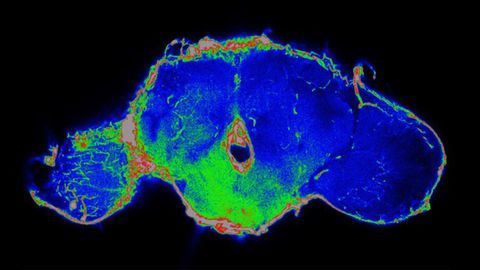 Fruit Fly Research Is Helping To Discover New Anticancer Strategies