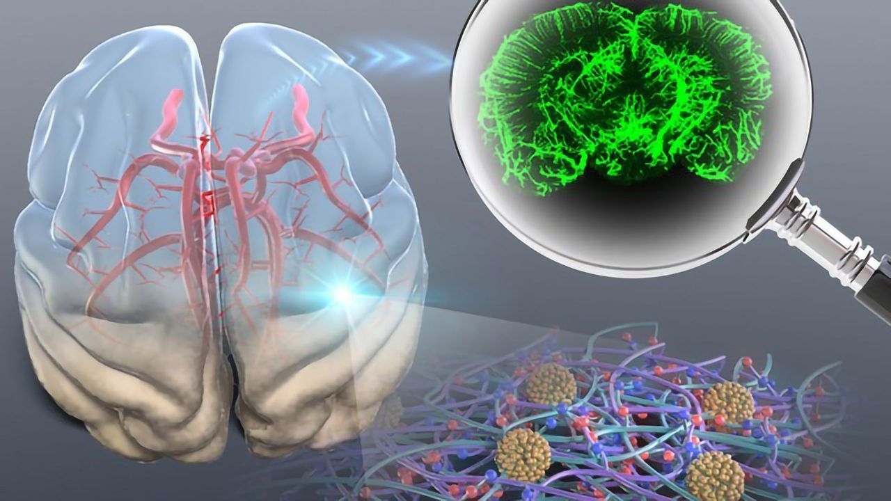 Improvements in Optical Tissue Clearing Help Clinicians To Diagnose Cancer